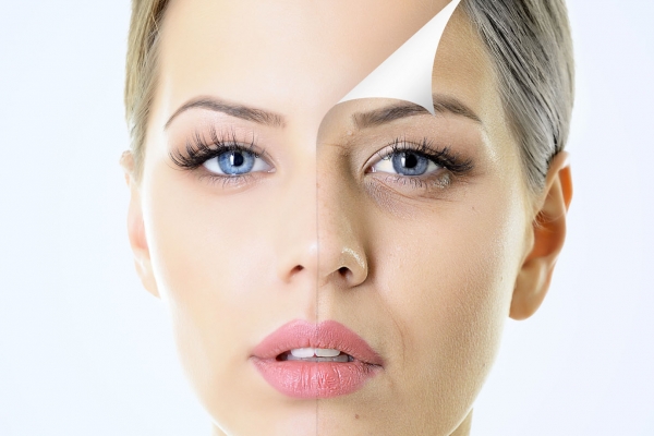 Kosmetisches Lifting